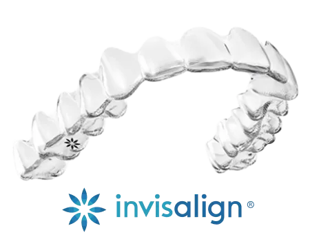 Invisalign Aligner