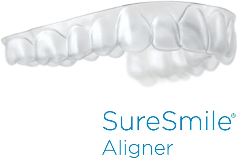 SureSmile Aligner