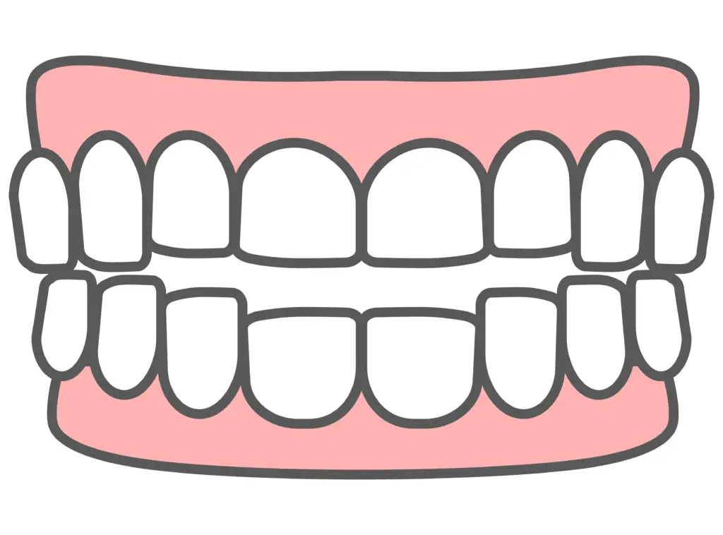 前歯が噛み合わない（開咬）