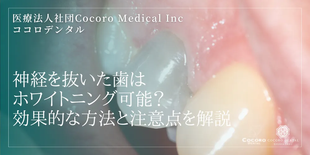 神経を抜いた歯はホワイトニング可能?効果的な方法と注意点を解説