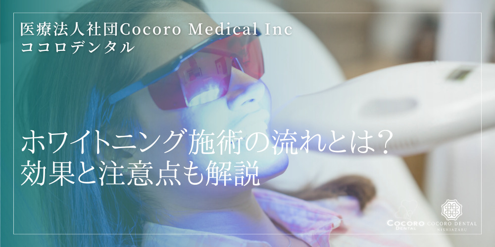 ホワイトニング施術の流れとは？効果と注意点も解説