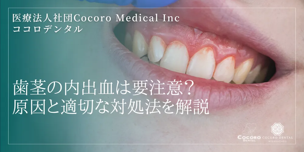 歯茎の内出血は要注意?原因と適切な対処法を解説