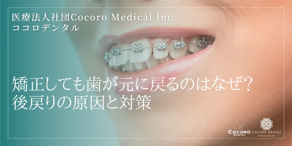 矯正しても歯が元に戻るのはなぜ?後戻りの原因と対策